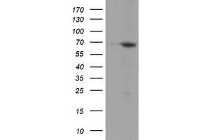 Western Blotting (WB) image for anti-N-Myristoyltransferase 2 (NMT2) antibody (ABIN1499784) (NMT2 anticorps)