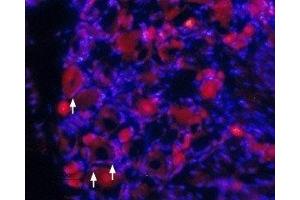 Expression of TrkA in rat DRG - Immunohistochemical staining of rat dorsal root ganglia (DRG) frozen sections using Anti-TrkA (extracellular) Antibody (ABIN7043385, ABIN7044771 and ABIN7044772), (1:100).