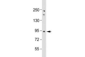 Western blot testing of human Jurkat cell lysate with NUP93 antibody at 1:1000. (NUP93 anticorps  (AA 752-782))