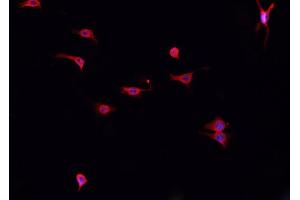 ABIN6276877 staining HepG2? (Cathepsin K anticorps  (N-Term))