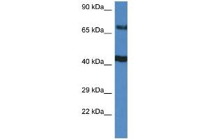 WB Suggested Anti-TNIP1 AntibodyTitration: 1.