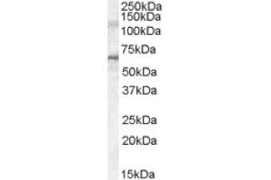 Image no. 1 for anti-Interleukin-1 Receptor-Associated Kinase 3 (IRAK3) (C-Term), (Internal Region) antibody (ABIN375025) (IRAK3 anticorps  (C-Term, Internal Region))