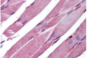 Human Skeletal Muscle (formalin-fixed, paraffin-embedded) stained with KALRN antibody ABIN213945 at 5 ug/ml followed by biotinylated goat anti-rabbit IgG secondary antibody ABIN481713, alkaline phosphatase-streptavidin and chromogen. (KALRN anticorps  (AA 1591-1605))