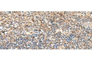 Immunohistochemistry of paraffin-embedded Human tonsil tissue using ECH1 Polyclonal Antibody at dilution of 1:50(x200)