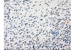 Immunohistochemical staining of paraffin-embedded lung tissue using anti-SSBmouse monoclonal antibody. (SSB anticorps)