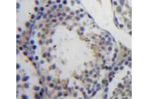 Used in DAB staining on fromalin fixed paraffin-embedded testis tissue