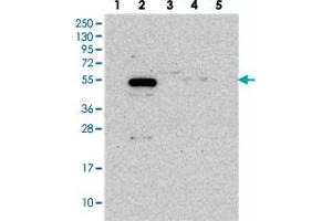 Western blot analysis of Lane 1: RT-4, Lane 2: U-251 MG, Lane 3: Human Plasma, Lane 4: Liver, Lane 5: Tonsil with C12orf34 polyclonal antibody  at 1:250-1:500 dilution. (FAM222A anticorps)