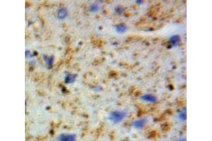 Used in DAB staining on fromalin fixed paraffin-embedded Brain tissue (GSTA4 anticorps  (AA 3-222))
