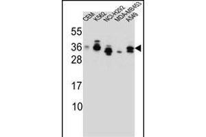SSX4 Antibody (Center) (ABIN657137 and ABIN2837900) western blot analysis in CEM,K562,NCI-,MDA-M,A549 cell line lysates (35 μg/lane). (SSX4 anticorps  (AA 63-91))