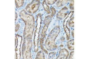 Immunohistochemistry of paraffin-embedded rat kidney using C9orf72 Rabbit pAb (ABIN7266391) at dilution of 1:100 (40x lens).