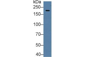Western blot analysis of Mouse Cerebrum lysate, using Human HIF2a Antibody (2 µg/ml) and HRP-conjugated Goat Anti-Rabbit antibody ( (EPAS1 anticorps  (AA 339-541))