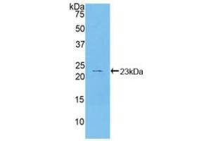 Western blot analysis of recombinant Human HSPb2. (HSPB2 anticorps  (AA 12-182))