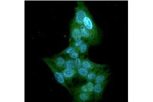 ICC/IF analysis of GSTT1 in HepG2 cells line, stained with DAPI (Blue) for nucleus staining and monoclonal anti-human GSTT1 antibody (1:100) with goat anti-mouse IgG-Alexa fluor 488 conjugate (Green). (GSTT1 anticorps)