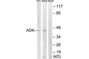 Western Blotting (WB) image for anti-Adenosine Kinase (ADK) (AA 1-50) antibody (ABIN2889523) (ADK anticorps  (AA 1-50))