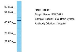 Host: Rabbit Target Name: FOXD4L1 Sample Tissue: Human Fetal Brain Antibody Dilution: 1ug/ml (FOXD4L1 anticorps  (N-Term))