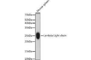 Western blot analysis of extracts of Mouse spleen, using Lambda Light chain antibody (ABIN7267847) at 1:1000 dilution. (IGLV1-51 anticorps)