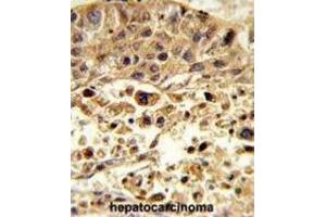 Immunohistochemistry (IHC) image for anti-Vacuolar Protein Sorting-Associated Protein 26A (VPS26A) antibody (ABIN3003886)