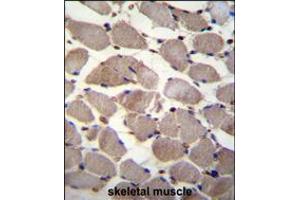PIK3C2A Antibody immunohistochemistry analysis in formalin fixed and paraffin embedded human skeletal muscle followed by peroxidase conjugation of the secondary antibody and DAB staining.
