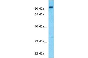 Host:  Rabbit  Target Name:  HGF  Sample Type:  293T Whole Cell lysates  Antibody Dilution:  0.