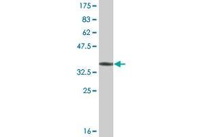 Western Blot detection against Immunogen (36. (COQ8A anticorps  (AA 1-100))