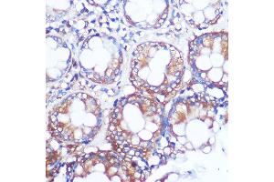Immunohistochemistry of paraffin-embedded human colon using Collagen X/COL10 Rabbit pAb (8604) at dilution of 1:100 (40x lens). (COL10A1 anticorps)
