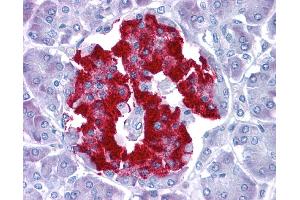 Immunohistochemistry (IHC) image for anti-PR Domain Containing 1, with ZNF Domain (PRDM1) (Middle Region) antibody (ABIN2792524)