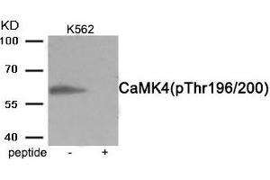 Western blot analysis of extracts from K562 cells treated with H2O2 using Phospho-CaMK4 (Thr196/200) antibody. (CAMK4 anticorps  (pThr196, pThr200))