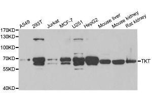 Western blot analysis of extracts of various cell lines, using TKT antibody. (TKT anticorps  (AA 1-280))