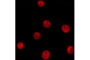 ABIN6277089 staining  Hela cells by IF/ICC.