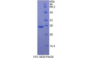 SDS-PAGE analysis of Rat MYH8 Protein.