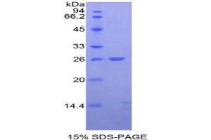 SDS-PAGE analysis of Mouse APC Protein.
