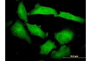 Immunofluorescence of monoclonal antibody to PCDHB10 on HeLa cell.
