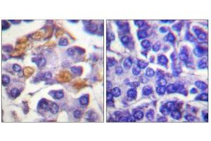Immunohistochemistry (IHC) image for anti-V-Raf-1 Murine Leukemia Viral Oncogene Homolog 1 (RAF1) (pTyr341) antibody (ABIN1847298) (RAF1 anticorps  (pTyr341))