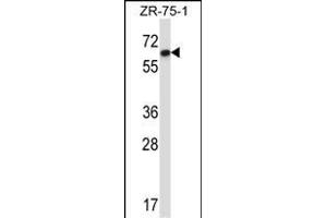 DCTN4 Antibody (N-term) (ABIN657377 and ABIN2846423) western blot analysis in ZR-75-1 cell line lysates (35 μg/lane). (Dynactin 4 anticorps  (N-Term))