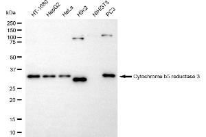 Western blotting analysis using cytochrome b5 reductase 3 antibody (ABIN7798244).