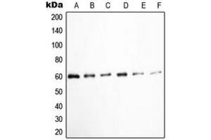 Western blot analysis of c-SRC (pY529) expression in K562 (A), HuvEc (B), Jurkat (C), COLO205 (D), HEK293T EGF-treated (E), A431 pervanadate-treated (F) whole cell lysates. (Src anticorps  (C-Term, pTyr529))