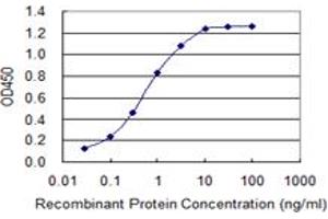 Detection limit for recombinant GST tagged SLC5A2 is 0.