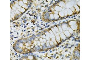 Immunohistochemistry of paraffin-embedded Human colon using GSTM2 Polyclonal Antibody at dilution of 1:100 (40x lens). (GSTM2 anticorps)