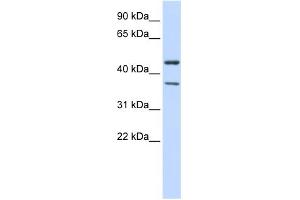 WB Suggested Anti-KCNJ4 Antibody Titration:  0. (KCNJ4 anticorps  (Middle Region))