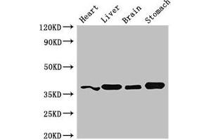 Western Blot Positive WB detected in: Mouse heart tissue, Mouse liver tissue, Mouse brain tissue, Mouse stomach tissue All lanes: YIPF3 antibody at 3 μg/mL Secondary Goat polyclonal to rabbit IgG at 1/50000 dilution Predicted band size: 39 kDa Observed band size: 39 kDa (YIPF3 anticorps  (AA 2-148))