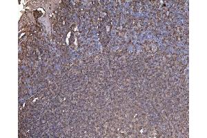 IHC analysis of RAB1B using anti-RAB1B antibody (ABIN7602809). (RAB1B anticorps  (C-Term))