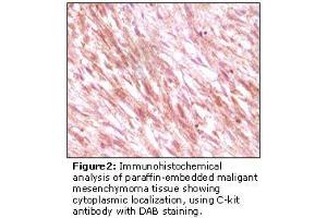 Image no. 2 for anti-Mast/stem Cell Growth Factor Receptor (KIT) antibody (ABIN232128) (KIT anticorps)