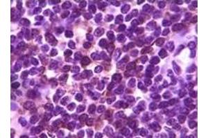 Immunohistochemistry (IHC) image for anti-B Lymphoid Tyrosine Kinase (BLK) (truncated) antibody (ABIN2464018) (BLK anticorps  (truncated))