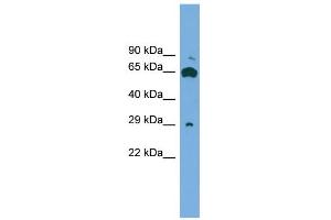 WB Suggested Anti-GLIPR1L1 Antibody Titration: 0. (GLIPR1L1 anticorps  (Middle Region))