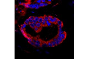 Immunofluorescence (IF) image for anti-Coiled-Coil and C2 Domain Containing 1A (CC2D1A) (AA 1-50) antibody (ABIN7448937) (CC2D1A anticorps  (AA 1-50))