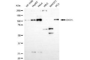 Western blotting analysis using CHD1L antibody (ABIN7798067). (Recombinant CHD1L anticorps)