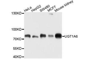 Western blot analysis of extracts of various cell lines, using UGT1A6 antibody. (UGT1A6 anticorps  (AA 65-270))