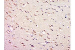 Paraformaldehyde-fixed, paraffin embedded rat brain tissue, Antigen retrieval by boiling in sodium citrate buffer(pH6) for 15min, Block endogenous peroxidase by 3% hydrogen peroxide for 30 minutes, Blocking buffer (normal goat serum) at 37°C for 20min, Antibody incubation with Rabbit Anti-SHP2 (Tyr81) Polyclonal Antibody, Unconjugated  at 1:500 overnight at 4°C, followed by a conjugated secondary and DAB staining