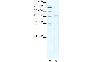 WB Suggested Anti-TBX5 Antibody   Titration: 5 ug/ml   Positive Control: HepG2 Whole Cell (T-Box 5 anticorps  (N-Term))