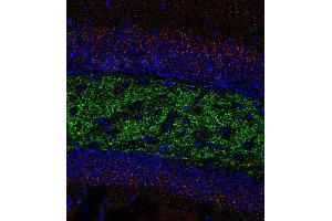 Indirect immunofluorescence labeling of PFA fixed, paraffin embedded mouse hippocampus section with anti-ZnT 3 (dilution 1 : 500; green) and rabbit anti-VGluT 2 (cat.
